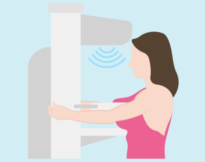 illustration d'une mammographie'