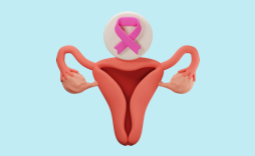 illustration du cancer colorectal